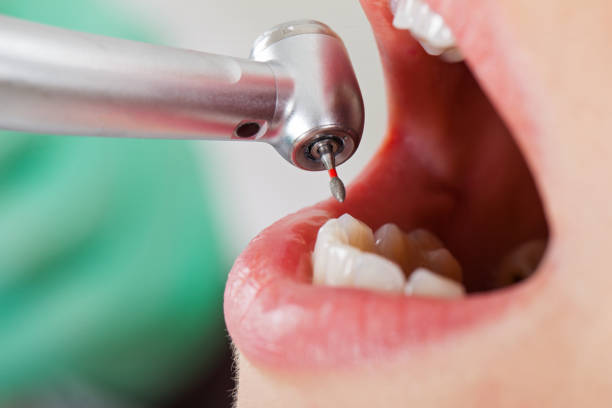 Best Pediatric Emergency Dentist in Natalia, TX